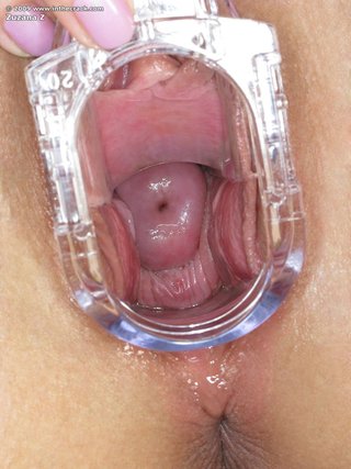 horny speculum